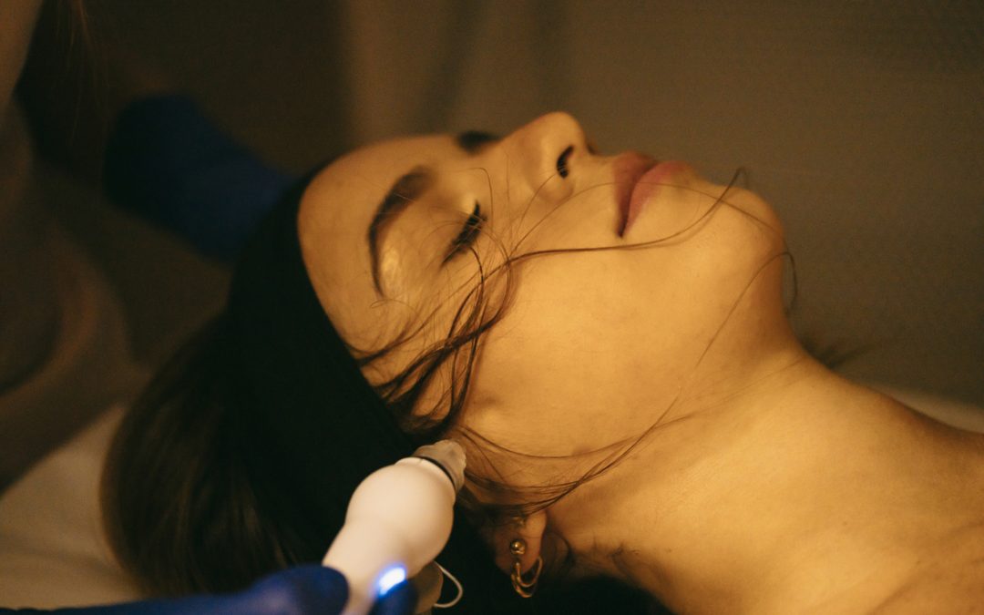 Peeling Superficiales