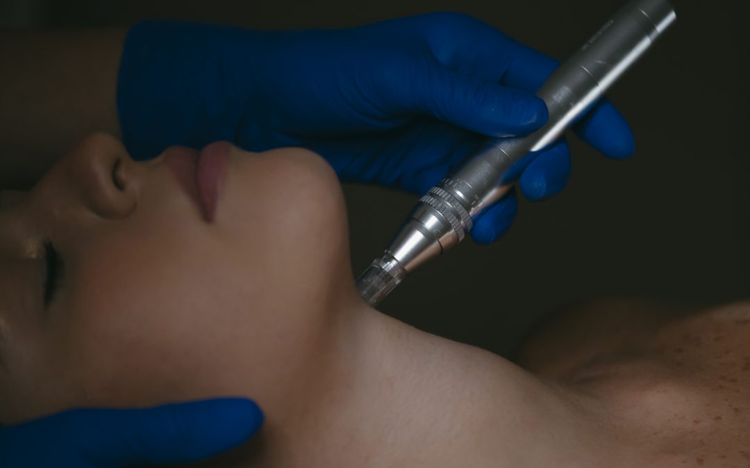 Microneedling